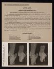 Lower Limb. Articulations, Knee-Joint - no. 2